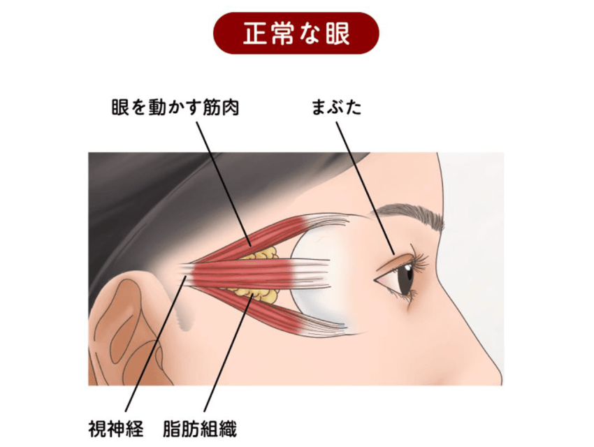 正常な眼