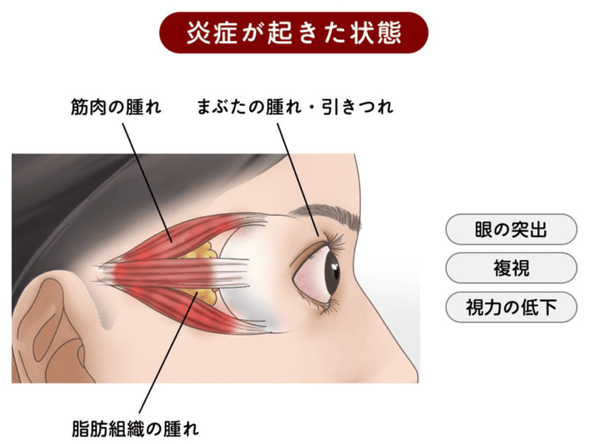 炎症が起きた状態